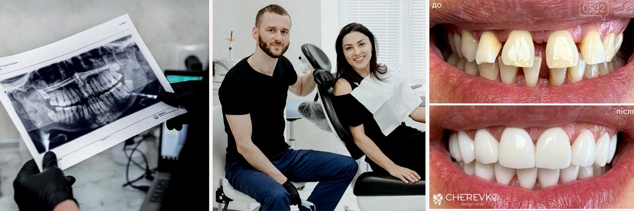 Засновник стоматологічної клініки «Cherevko clinic»  Федір Червко розповів, чому у Полтаву навіть у воєнний час їдуть лікувати зуби з усієї України та з-за кордону