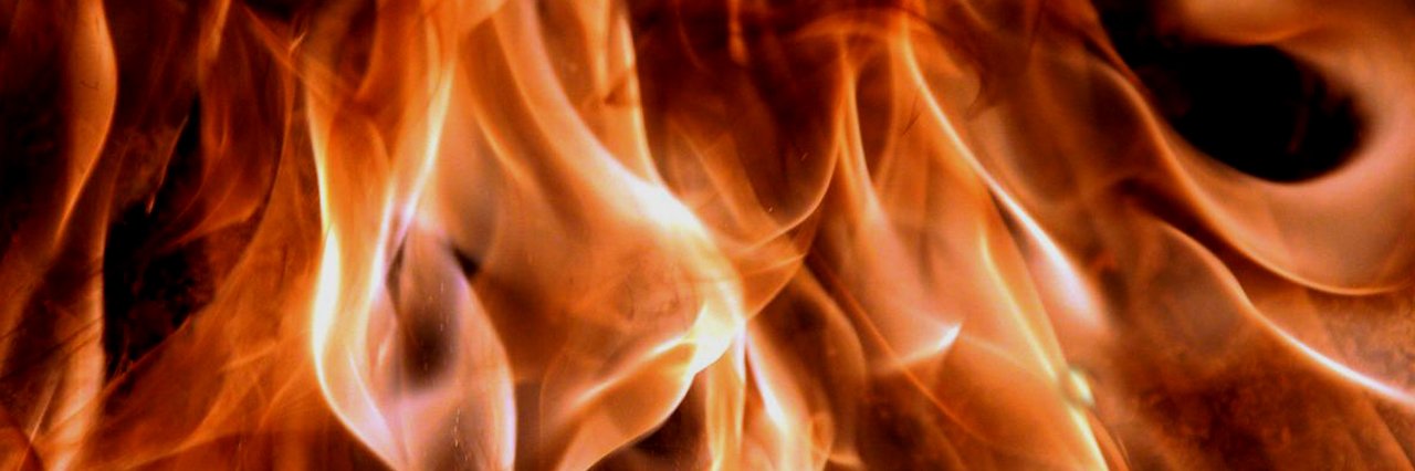 На Полтавщині під час пожежі отримали опіки чоловік і жінка